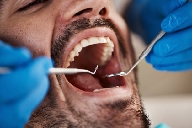 Best Emergency Tooth Extraction in Waite Park, MN