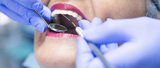 Best Emergency Wisdom Teeth Removal in Waite Park, MN
